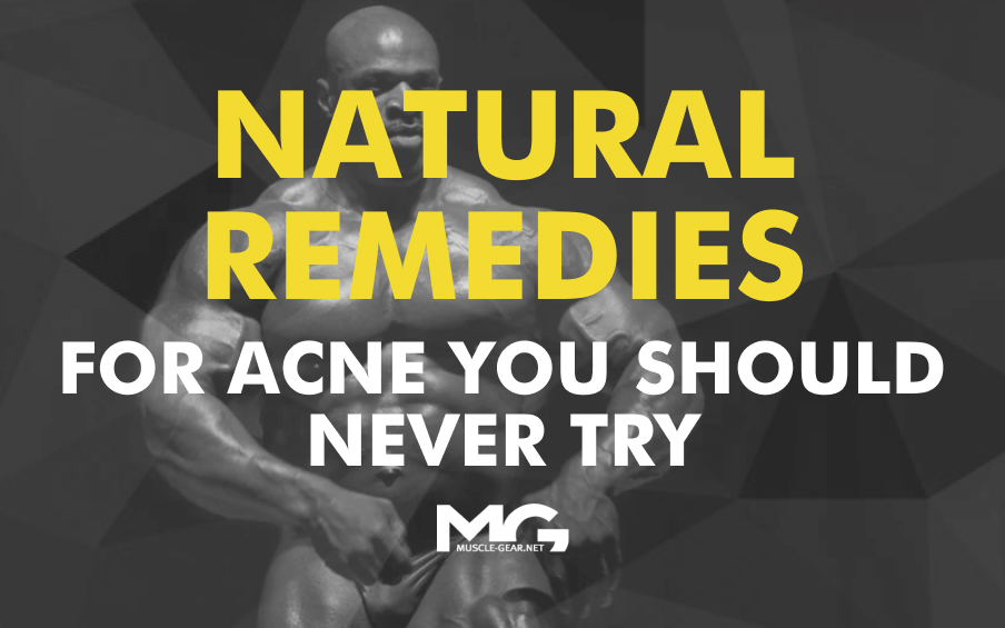 Natural Remedies for Acne You Should Never Try